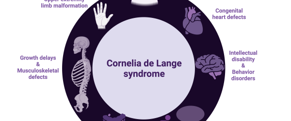 Schema CdLS