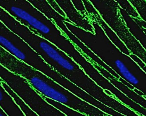 bbb_neuroinflammation
