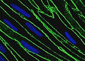 bbb_neuroinflammation