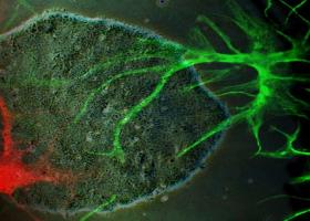 stem cells